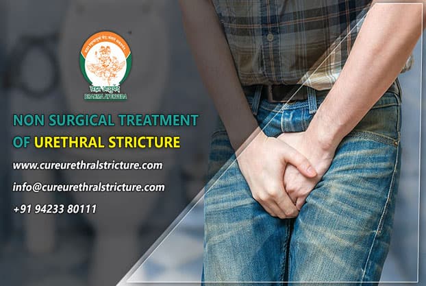 Non Surgical Treatment of Urethral Stricture