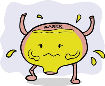 Neurogenic Bladder 1.1