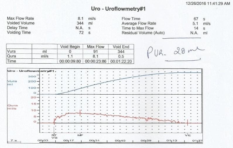 Uroflowmetry 12.1