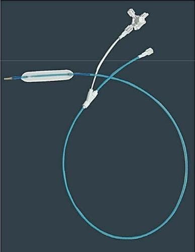 Balloon dilatation
