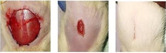 Pathology of Urethral Stricture