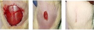 stricture urethral pathology